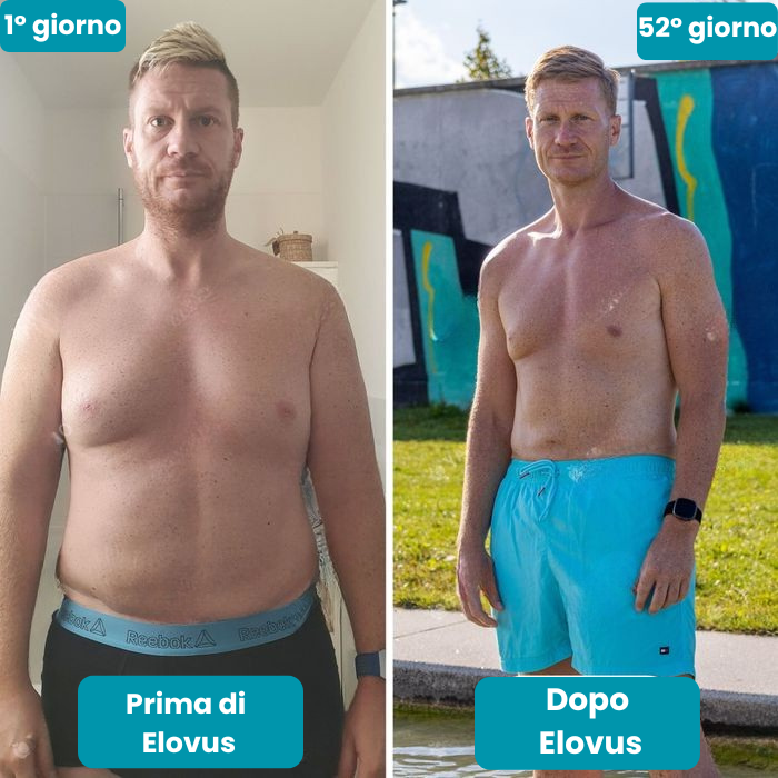 Elovus™